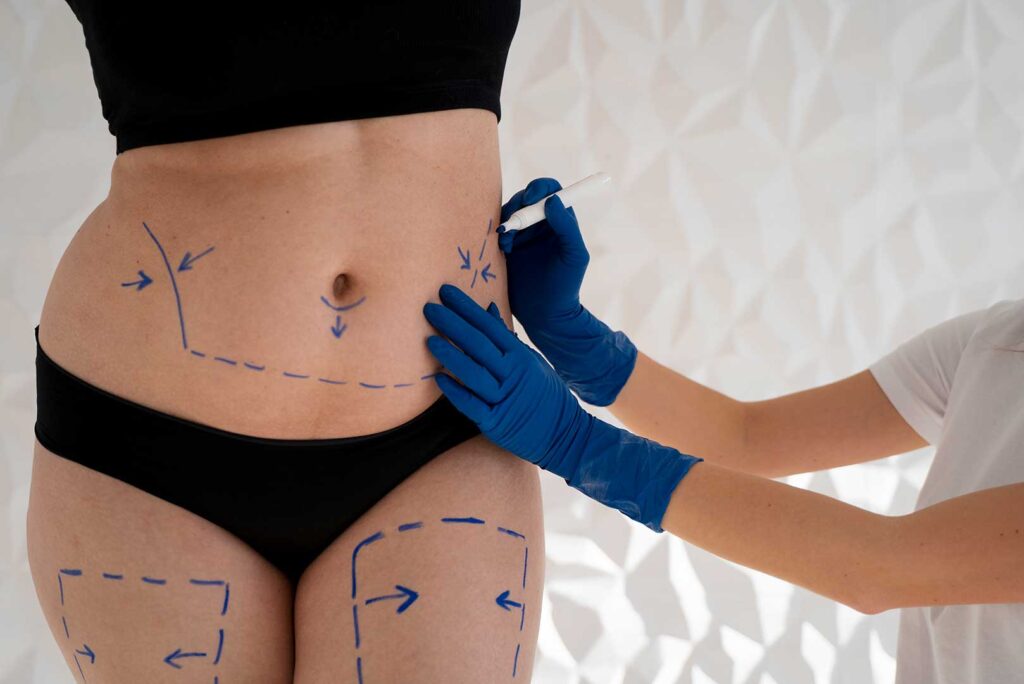 Lipofilling en 2025